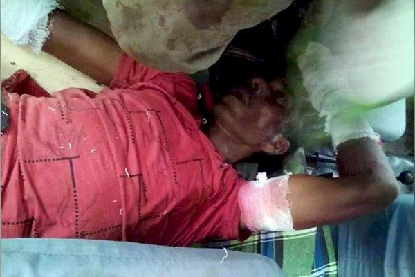 চা বাগানে বন্য শূকরের আক্রমণে শ্রমিক নিহত