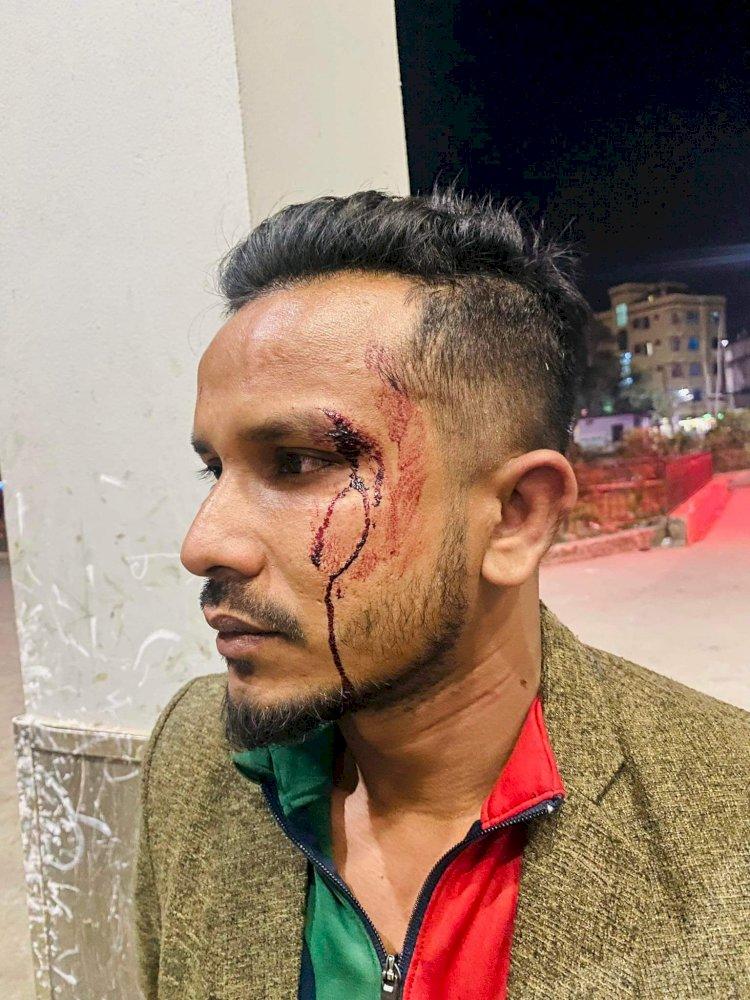 সুনামগঞ্জে মোটরসাইকেল থামিয়ে ছিনতাই, আহত দুই ভাই